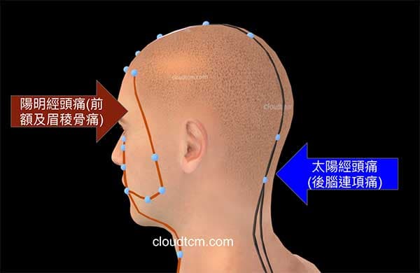 太陽經與陽明經頭痛