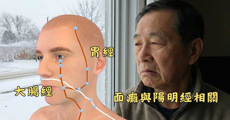 一個人出現面癱，與陽明經異常有關