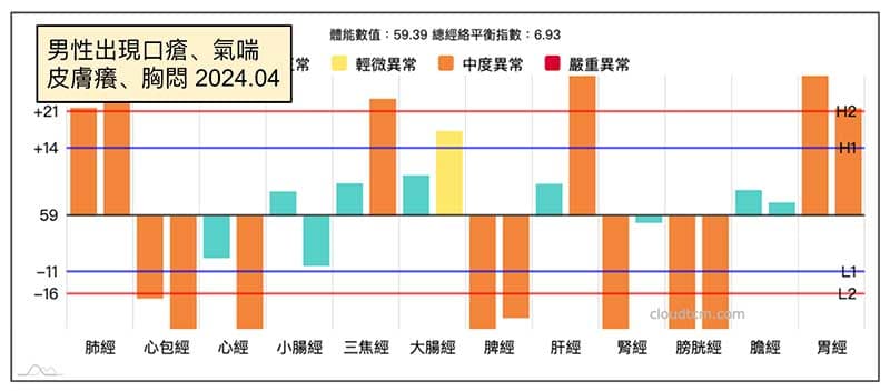 天氣炎熱後開始出現口瘡口角炎案例