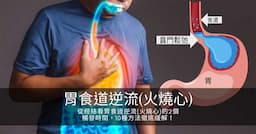 從經絡看胃食道逆流的2個觸發期間，10種方法徹底緩解！