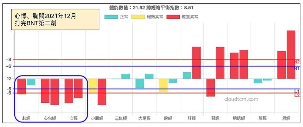 打完第二劑BNT出現的經絡現象