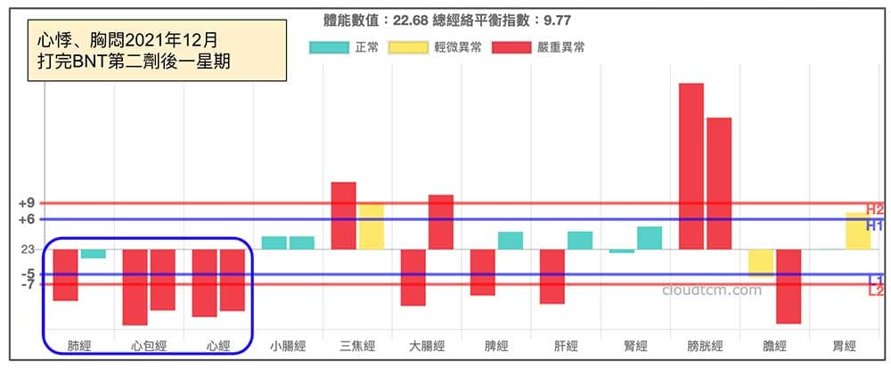 打完第二劑BNT之後一星期，出現類似的經絡現象