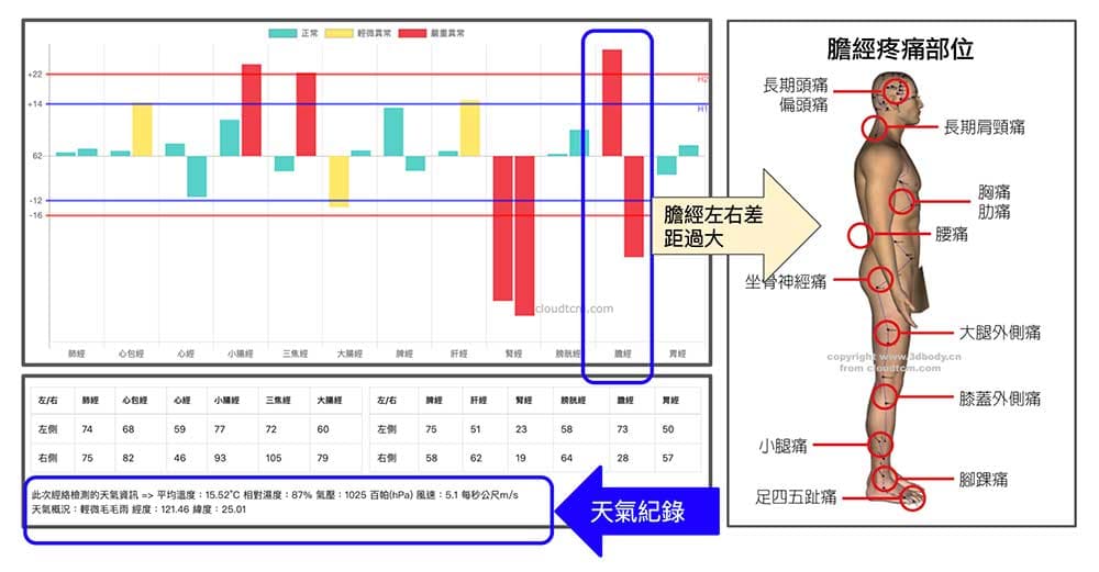天氣與膽經部位上的疼痛息息相關