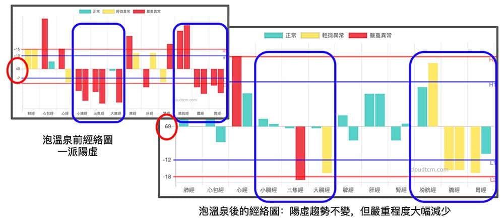 泡完溫泉後，陽虛經絡明顯改善
