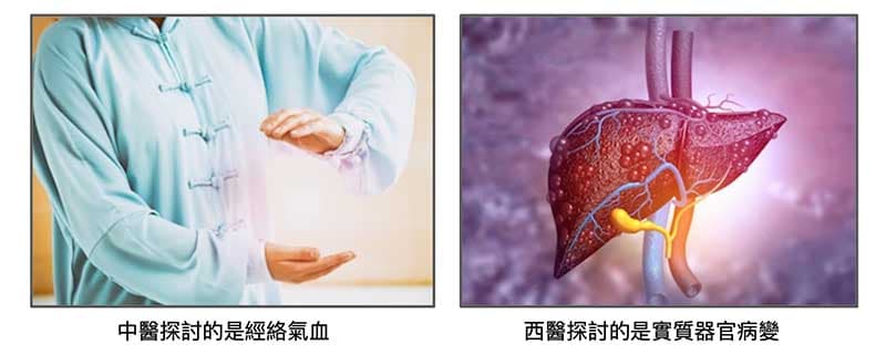 中醫西醫不一樣