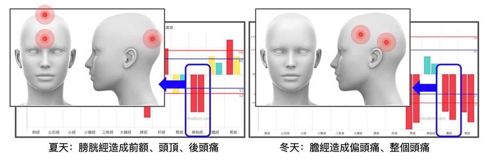 不同的經絡異常，頭痛的位置也不一樣