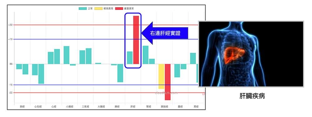 右邊肝經實證，與實質器官的肝臟有關聯
