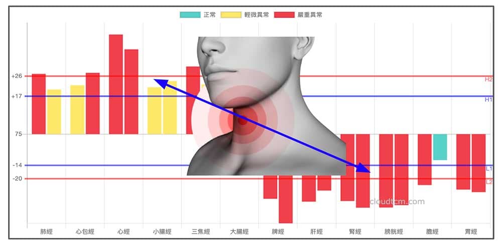 上實下虛的經絡型態，經常會出現慢性喉嚨痛