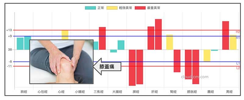 某會員在夏天出現的膝蓋痛經絡圖