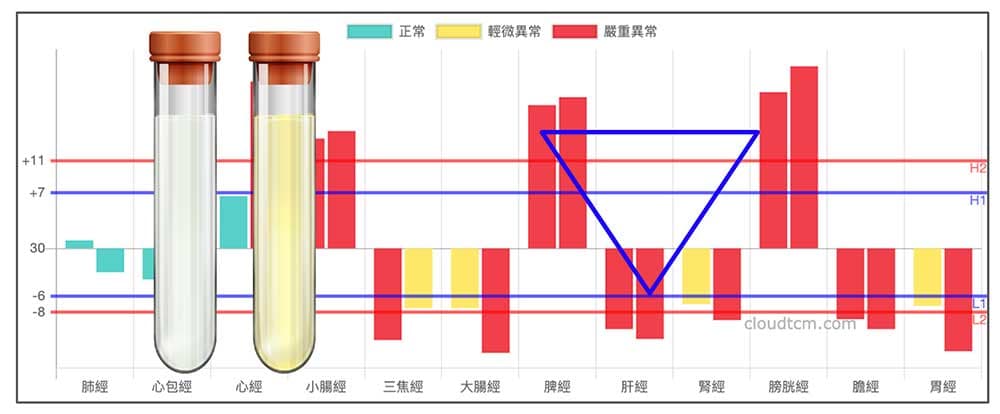 冬天常見的倒鐵三角經絡型態，常出現小便清長現象