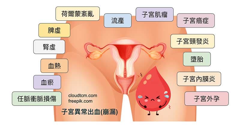 從中醫與西醫的角度來看崩漏的原因非常多