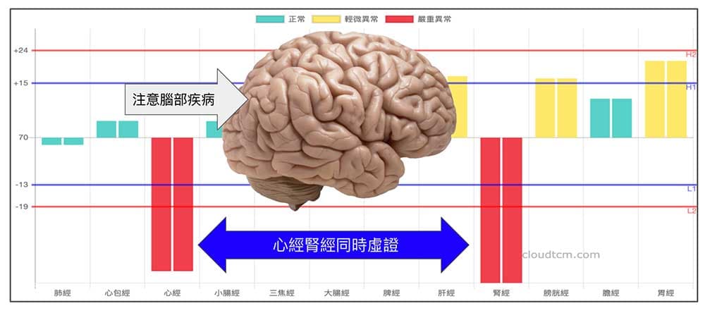 心經與腎經同時虛證時，要開始注意預防腦部相關疾病