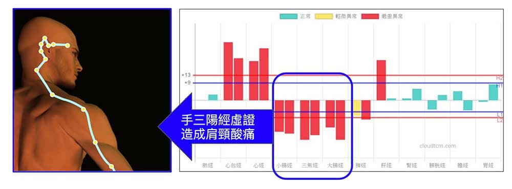 冷氣與喝冰水讓手三陽經出現虛證，形成肩頸酸痛