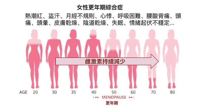 女性更年期受到荷爾蒙影響，出現許多症狀