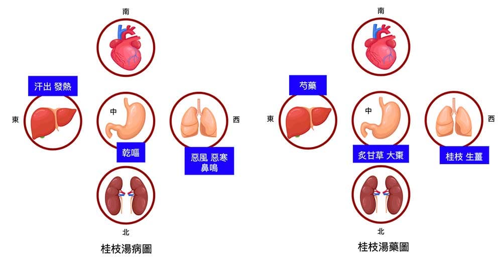 李陽波提出的桂枝湯病圖及藥圖