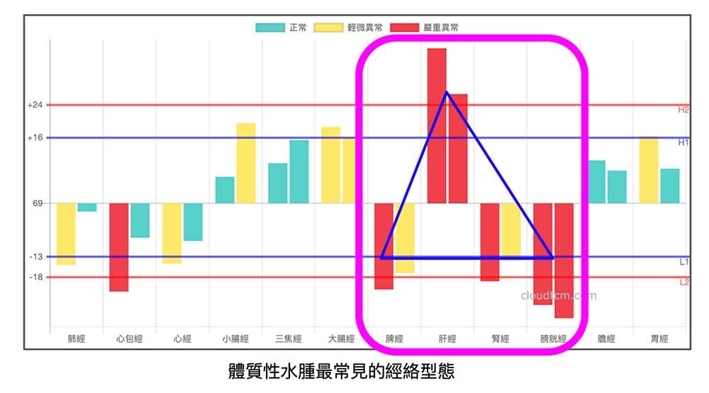 體質性水腫最常見的經絡型態