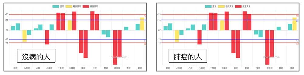 沒病的人其實與癌症的患者擁有類似的經絡型態