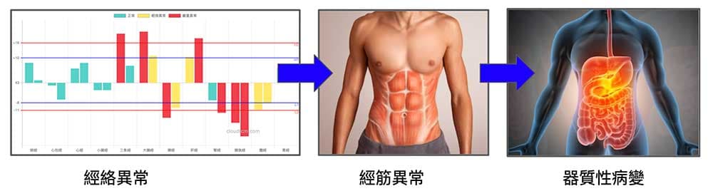 從經絡異常演變成器質性病變時間很長，每個人都有足夠時間預防