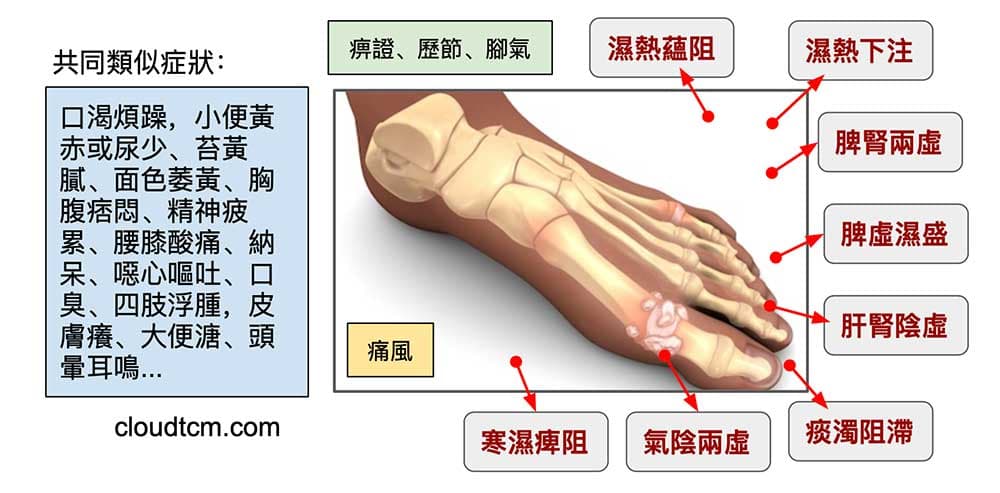 腳大趾痛的中醫證候