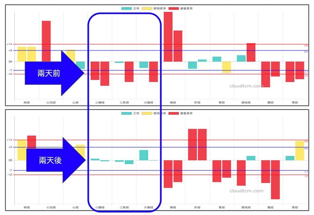 比較兩天前後的經絡圖，依然可以展現改善效果