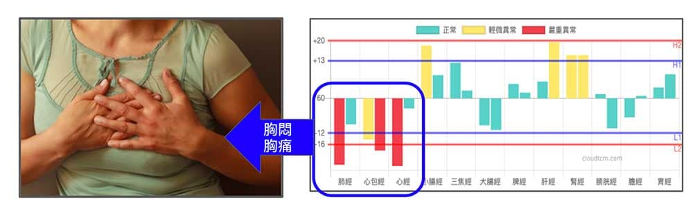 某位女性胸悶胸痛，完全符合異常經絡症狀