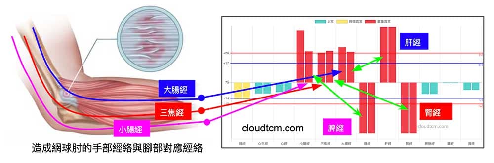 網球肘附近的經絡，與腳部的肝經、脾經與腎經相對應