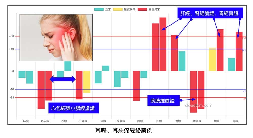 通往耳朵的經絡異常，造成耳鳴耳朵痛
