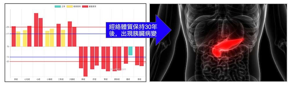 一種經絡體質要累積數十年功力，才會形成器官病變