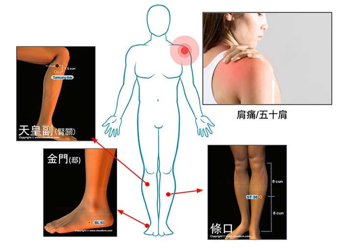 位於腳上的穴道，竟然也可以治療肩痛