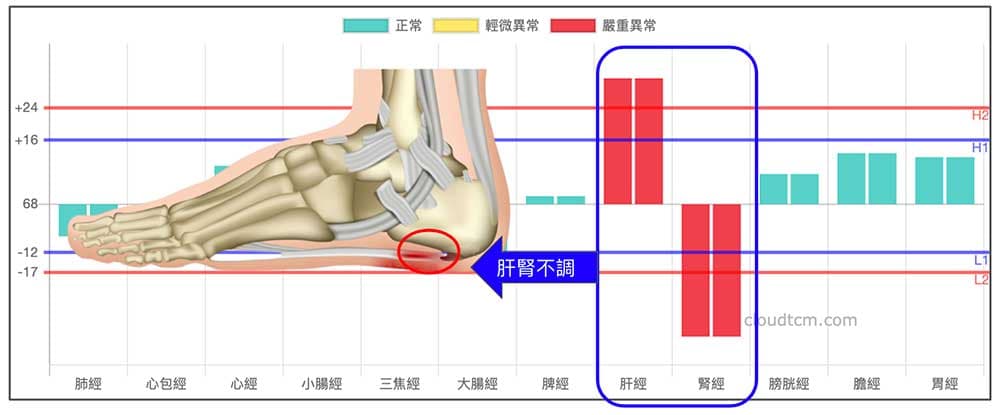 肝腎不調幾乎是現代人的經絡體質常態