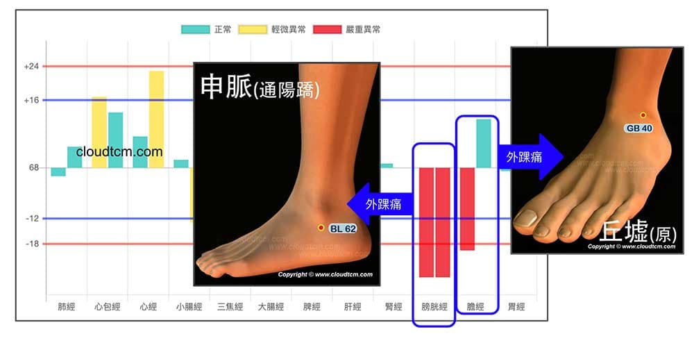 膀胱與膽經異常，腳踝自動出現疼痛