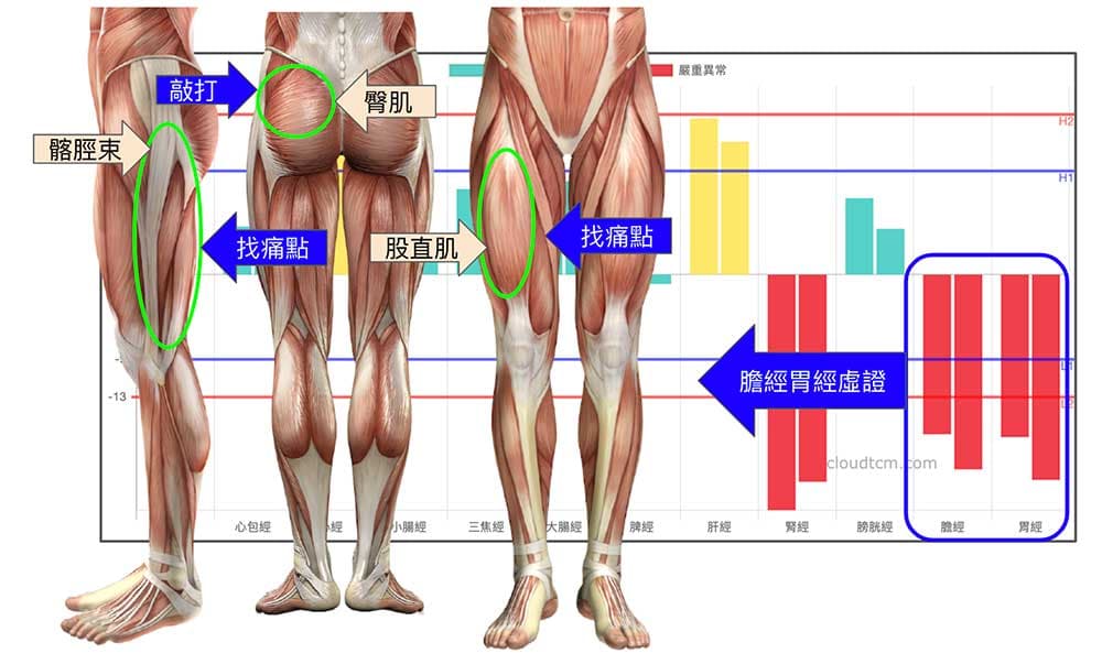 去除膽經與胃經上的經筋肌肉沾粘
