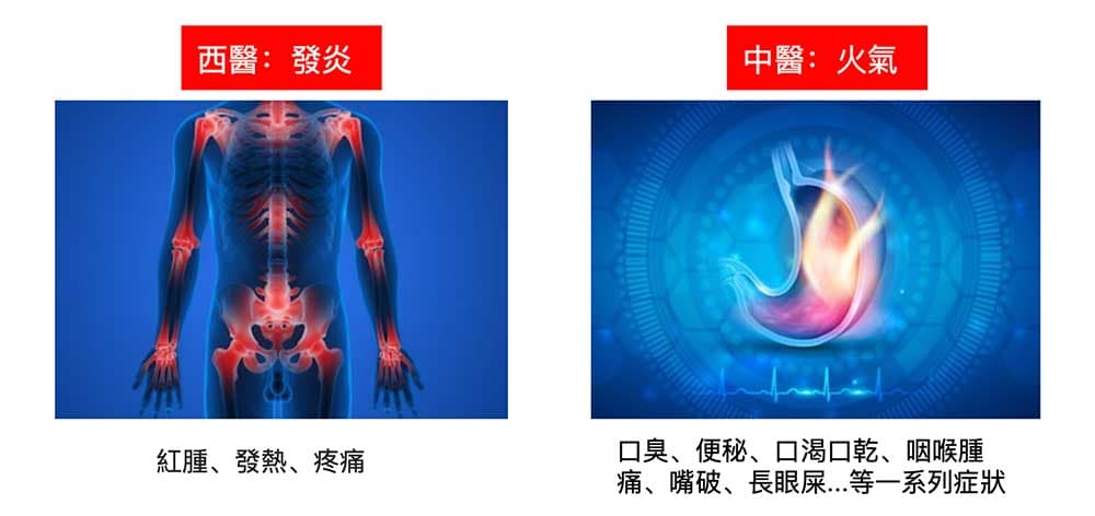 西醫有發炎的概念，中醫的火氣是指一系列的熱性症狀