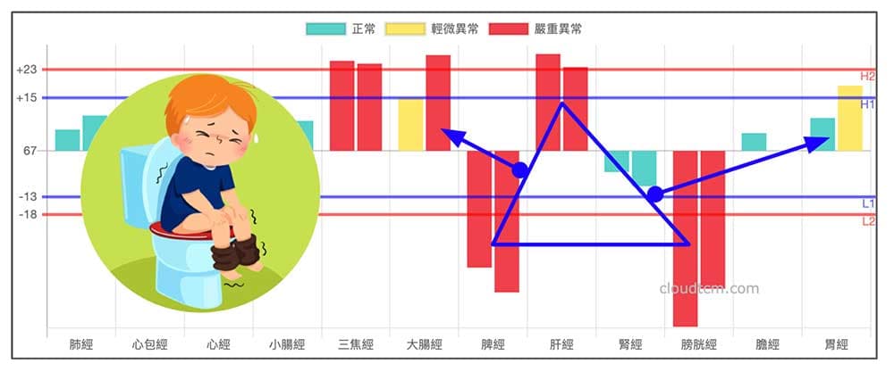 鐵三角經絡型態是塑造便秘的基本經絡模型