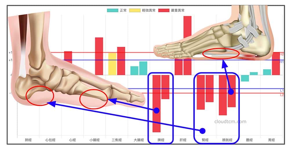 鐵三角經絡型態，到了一定年齡之後就會出現腳痛