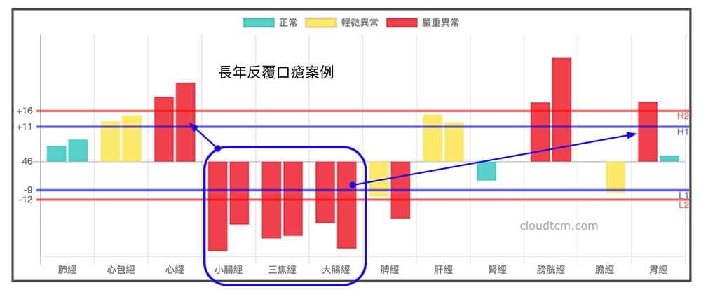 長年反覆口瘡者，手三陽經虛證，心經心包經實證