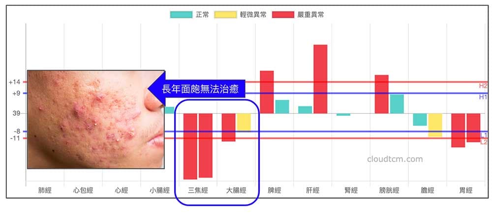許多長期面皰不癒者，其實是屬於陽虛寒性體質