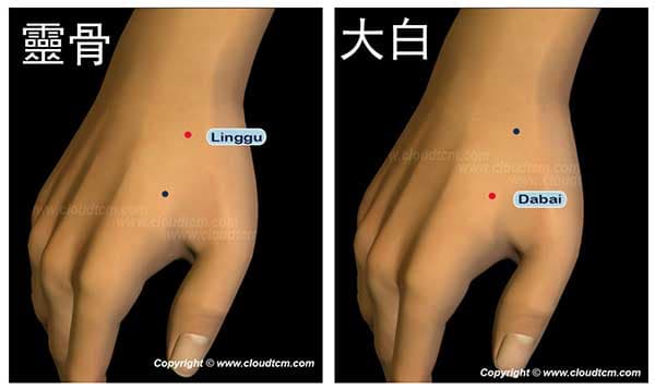 靈骨穴與大白穴治療臀部與下肢痛效果快速