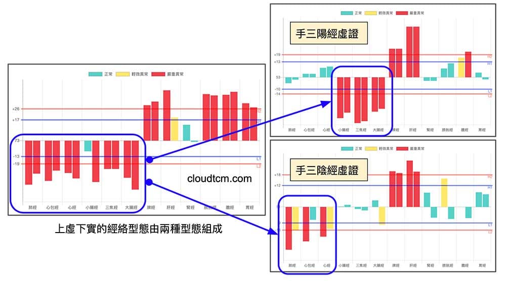 上虛下實經絡型態，其實包含手三陽經虛證