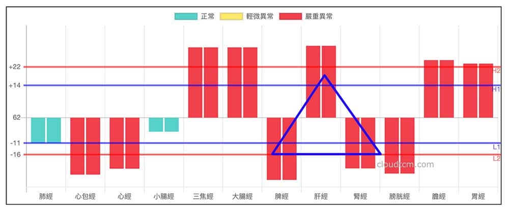 鐵三角經絡型態變化型，容易出現心律不整j