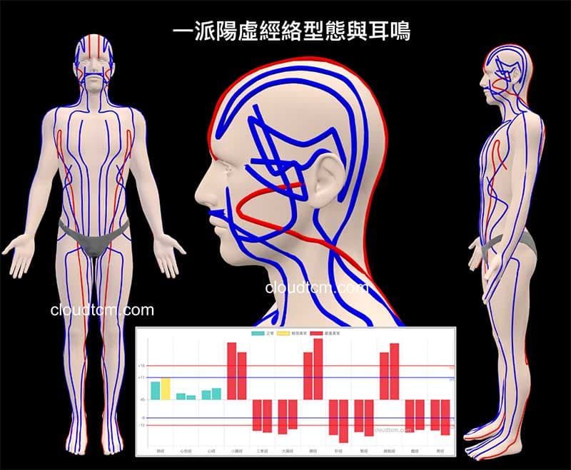 一派陽虛經絡型態最容易出現耳鳴