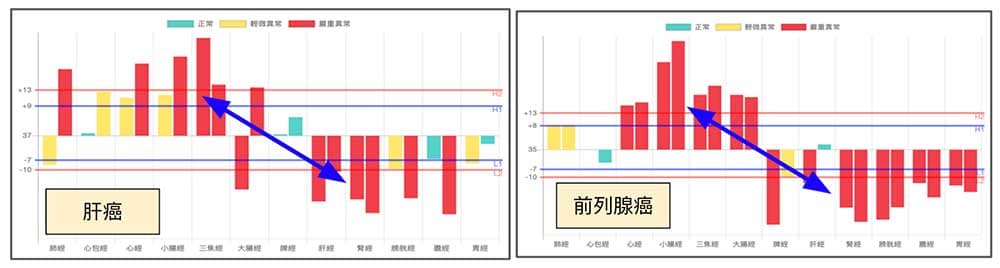 上實下虛與癌症