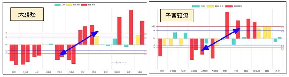 上虛下實癌症