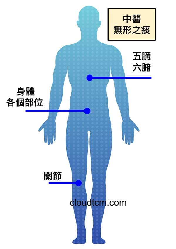 中醫所說的痰主要是無形之痰
