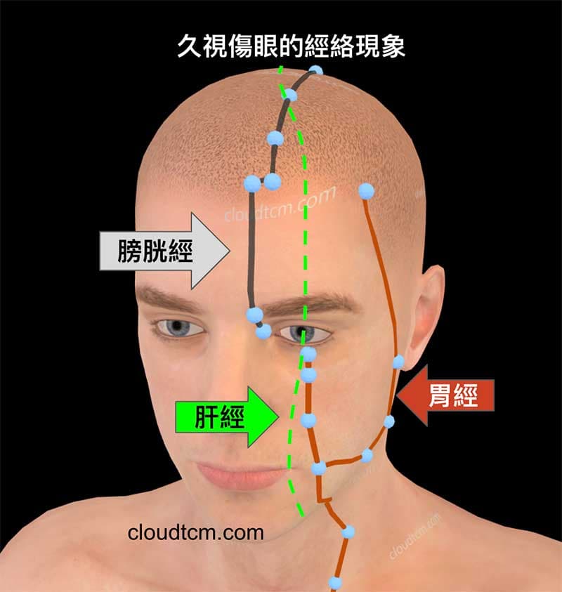 久視傷眼的經絡現象(肝經,胃經,膀胱經)