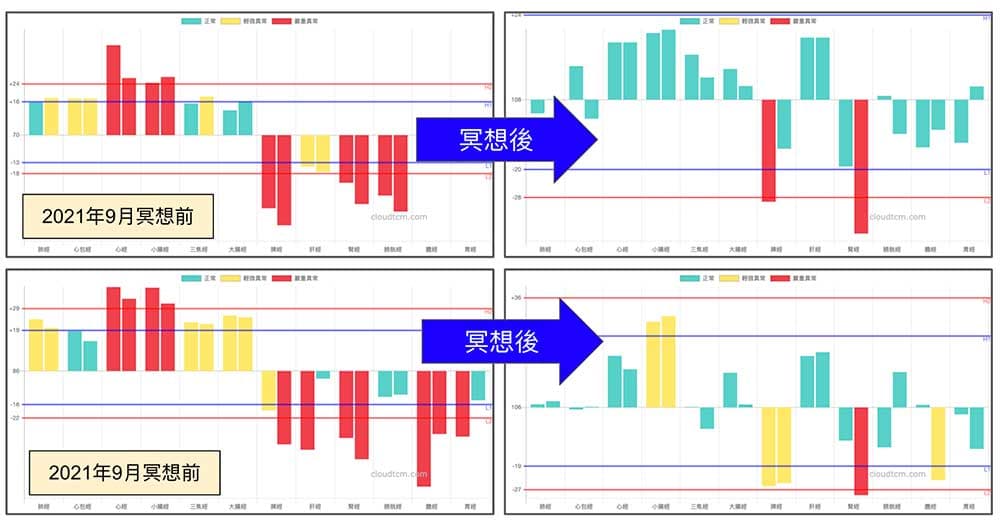 進行冥想後，良導絡異常經絡明顯改善