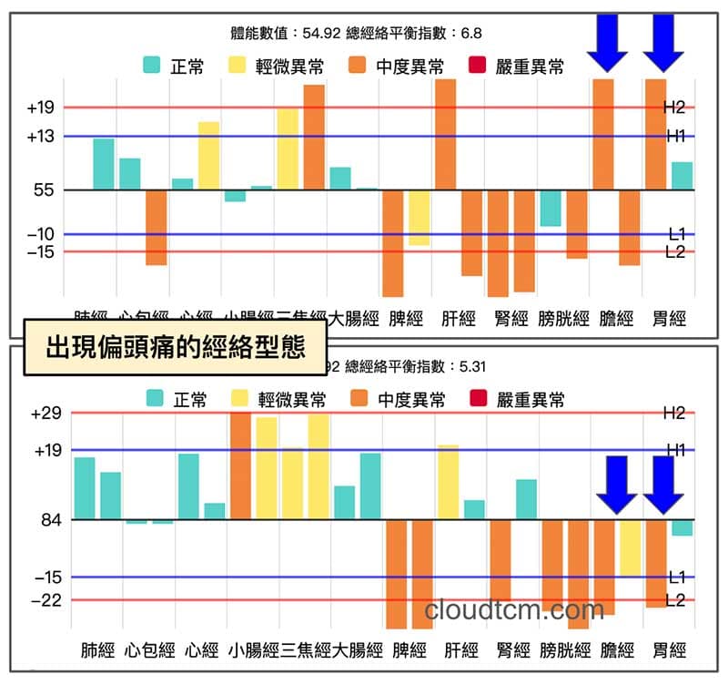 出現偏頭痛的經絡型態