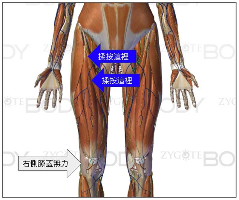 右膝無力阿是穴