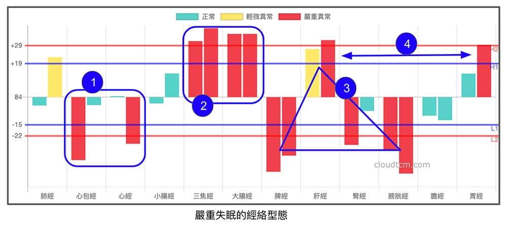 嚴重失眠的經絡型態，要掌握四個重點