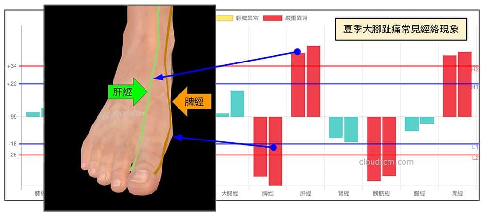 夏季肝經實證，脾經虛證容易出現大腳趾痛